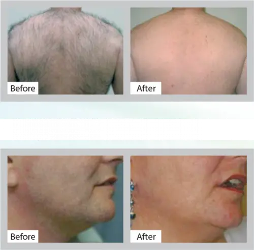 Radiance Beauty Clinic Folkestone null