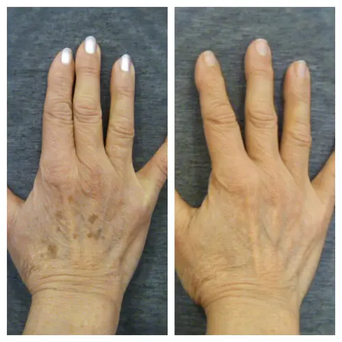 Radiance Beauty Clinic Folkestone null