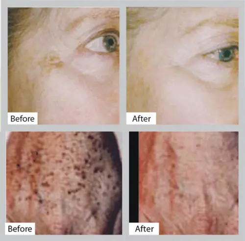 Radiance Beauty Clinic Folkestone null