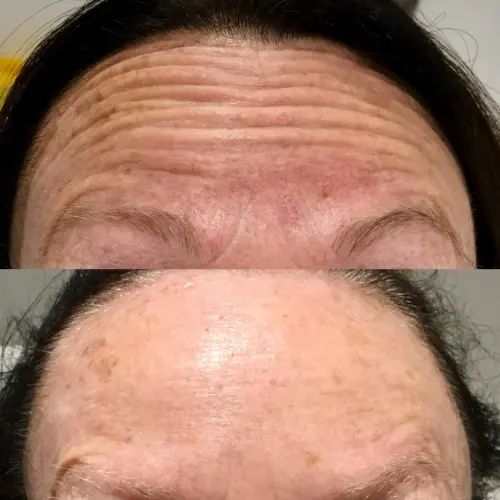 Radiance Beauty Clinic Folkestone null