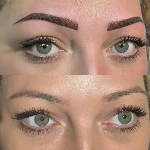 Radiance Beauty Clinic Folkestone null