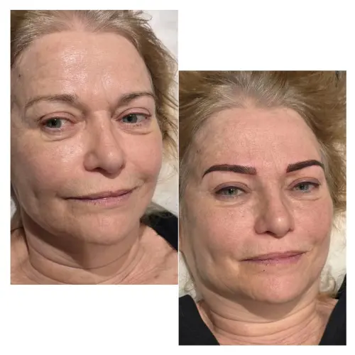 Radiance Beauty Clinic Folkestone null