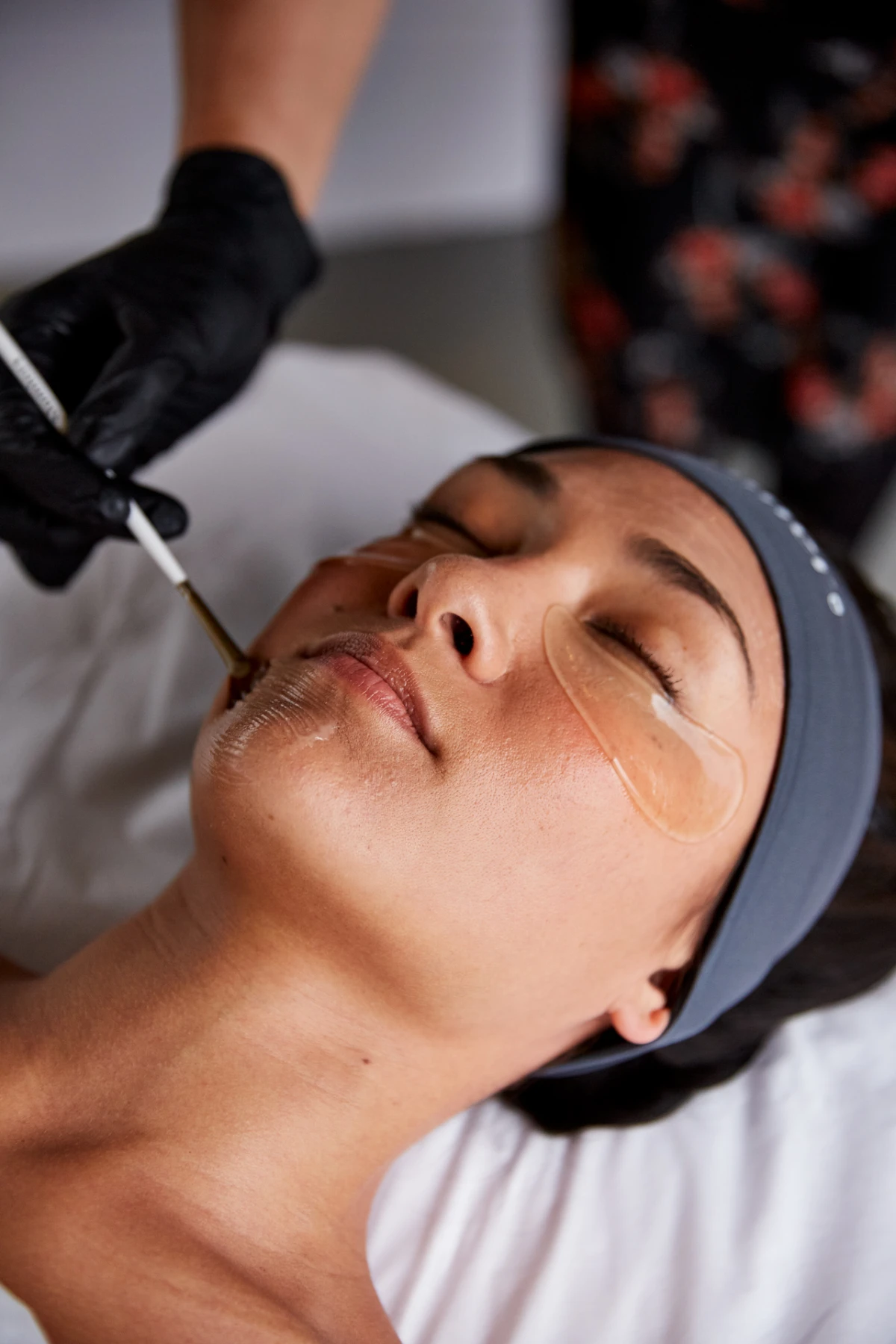 Microdermabrasion, RF-Skin Tightening, Electro mesotherapy, LED Light Therapy, Micro and Nano needling