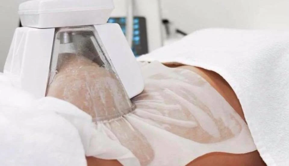 Body Sculpting technologies  Freeze (Fat Freeze), HIFU, Radio Frequency (RF) Fat Melting, RF Skin Tightening, Shockwave