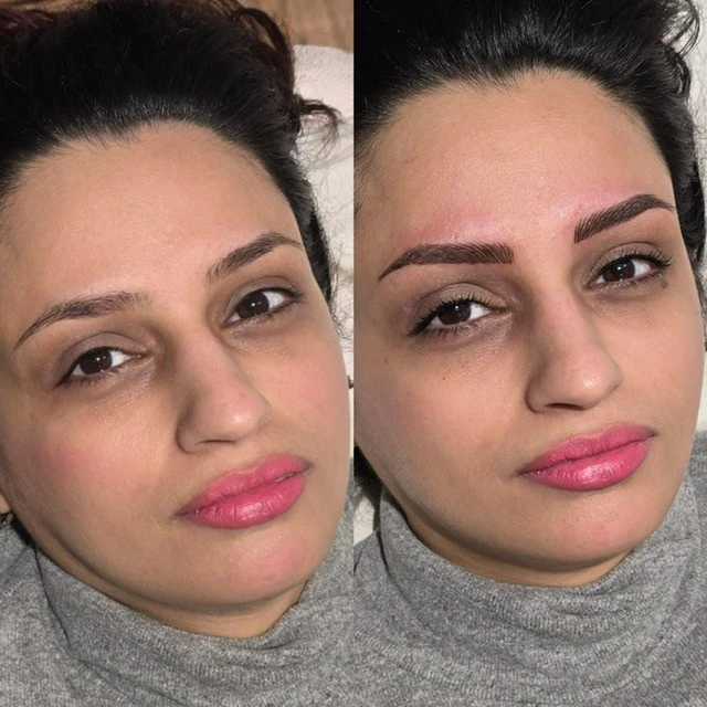 Enhance your natural beauty with expert semi-permanent makeup treatments at Radiance. Using professional-grade products and advanced techniques, we create long-lasting, flawless results tailored just for you.